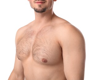 Photo of Young man with hairy chest on white background, closeup. Epilation procedure