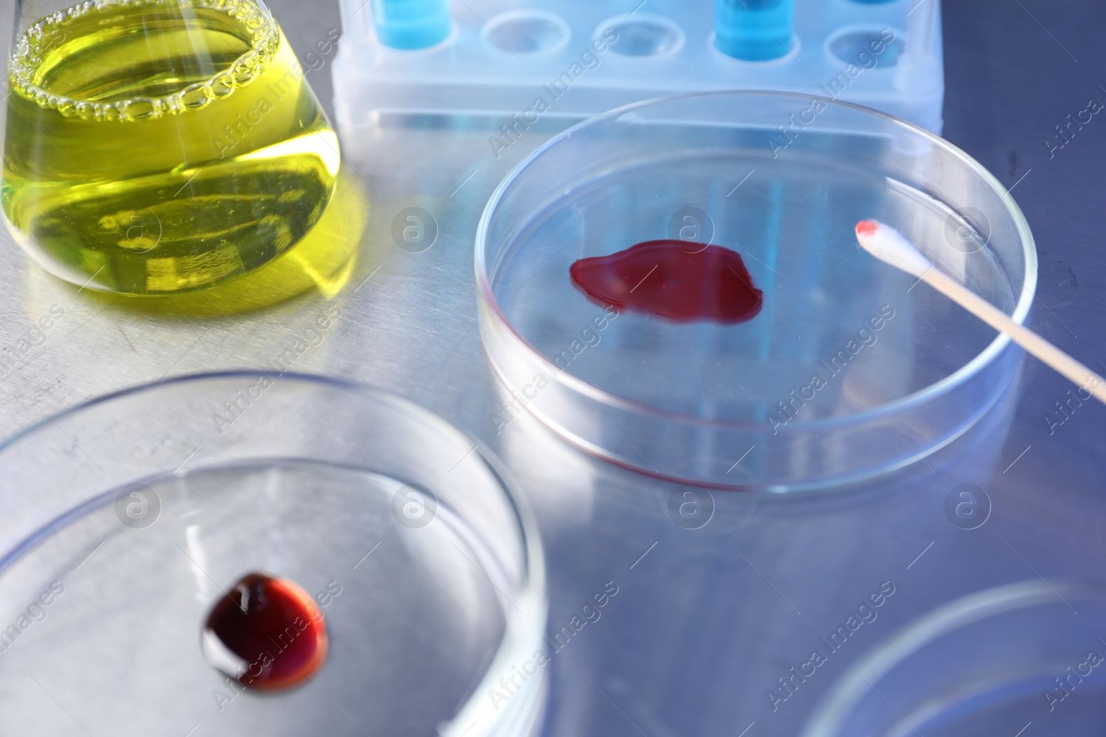 Petri dishes with samples on table, closeup Photo of Petri dishes with samples on table, closeup