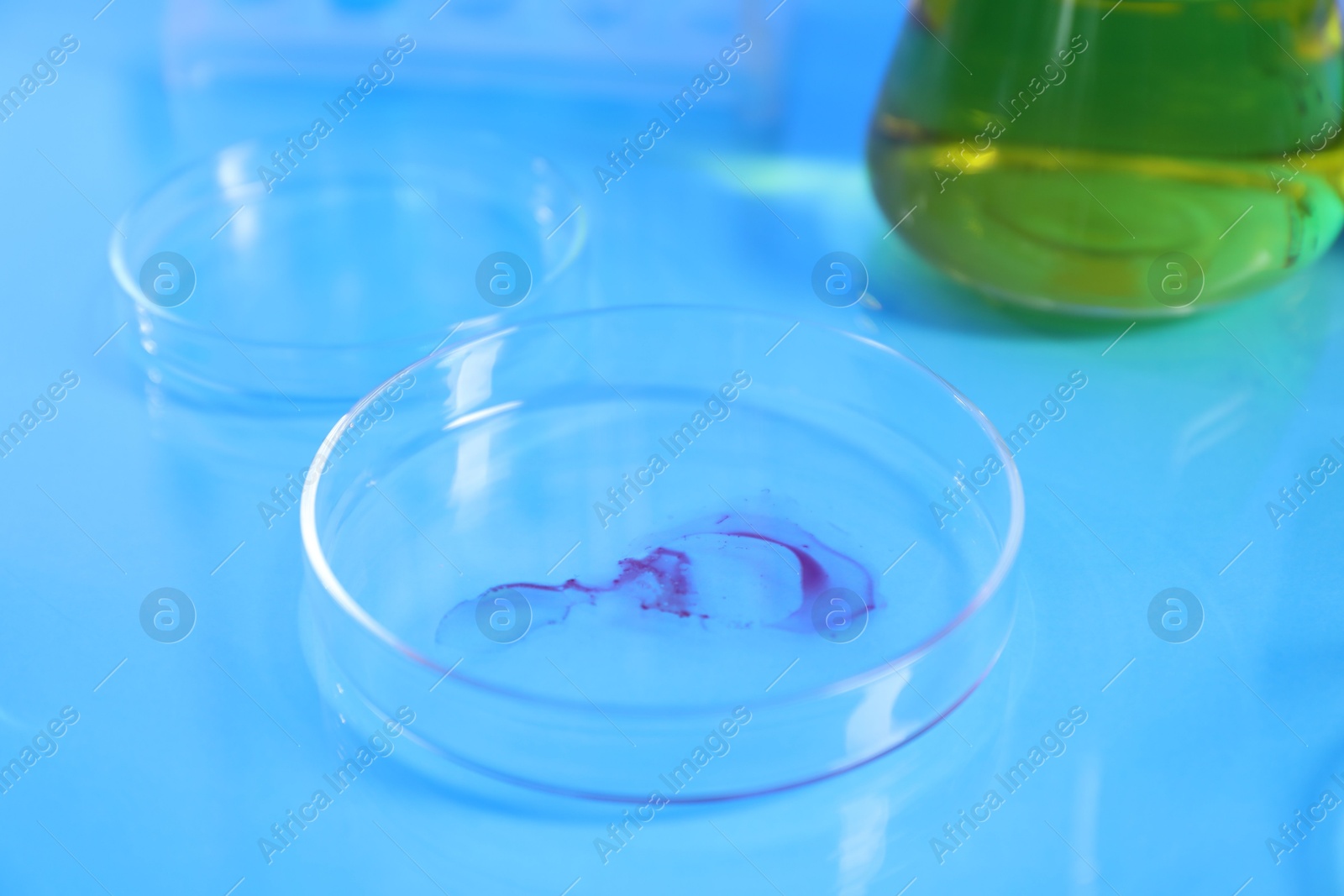 Petri dishes with samples on light blue table, closeup Photo of Petri dishes with samples on light blue table, closeup