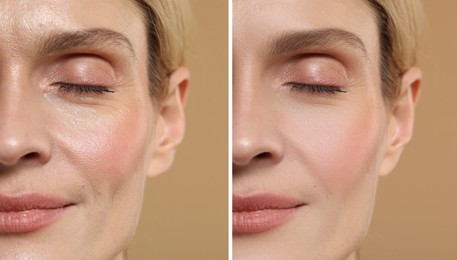 Image of Woman showing face before and after collagen consumption on beige background, closeup. Collage of photos comparing skin condition