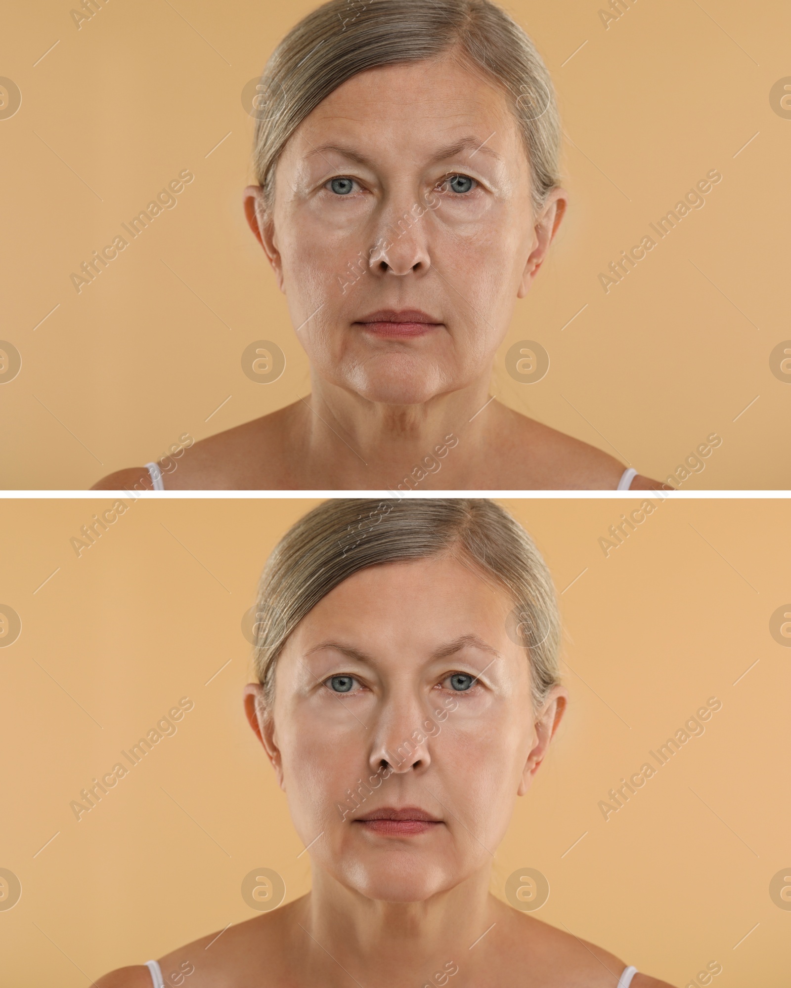 Senior woman showing face before and after collagen consumption on beige background. Collage of photos comparing skin condition Image of Senior woman showing face before and after collagen consumption on beige background. Collage of photos comparing skin condition