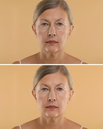 Image of Senior woman showing face before and after collagen consumption on beige background. Collage of photos comparing skin condition