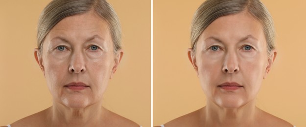 Image of Senior woman showing face before and after collagen consumption on beige background. Collage of photos comparing skin condition