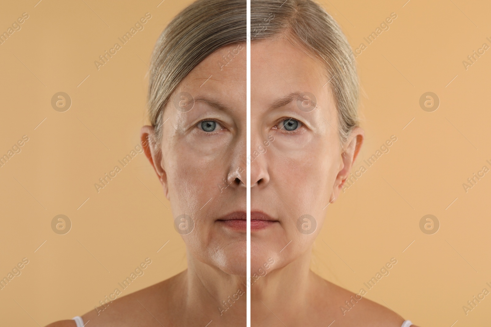 Senior woman showing face before and after collagen consumption on beige background. Collage of photos comparing skin condition Image of Senior woman showing face before and after collagen consumption on beige background. Collage of photos comparing skin condition