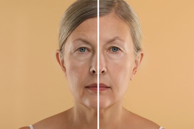 Image of Senior woman showing face before and after collagen consumption on beige background. Collage of photos comparing skin condition