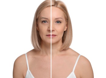 Image of Woman showing face before and after collagen consumption on white background. Collage of photos comparing skin condition