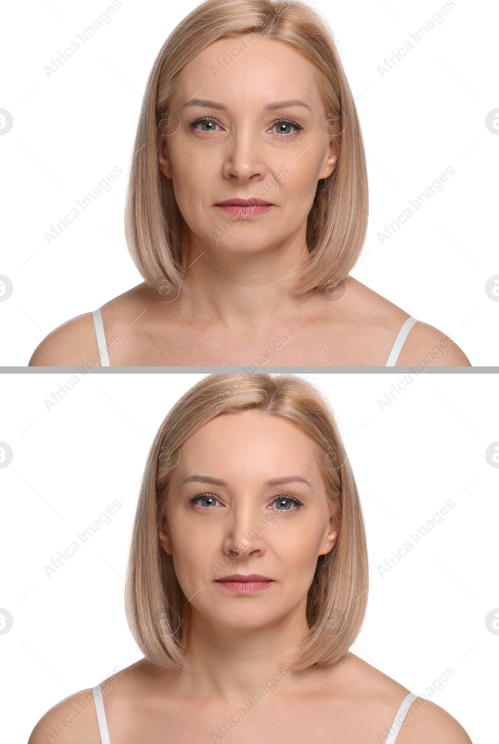 Woman showing face before and after collagen consumption on white background. Collage of photos comparing skin condition Image of Woman showing face before and after collagen consumption on white background. Collage of photos comparing skin condition