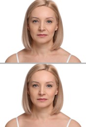 Image of Woman showing face before and after collagen consumption on white background. Collage of photos comparing skin condition