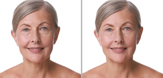 Image of Senior woman showing face before and after collagen consumption on white background. Collage of photos comparing skin condition