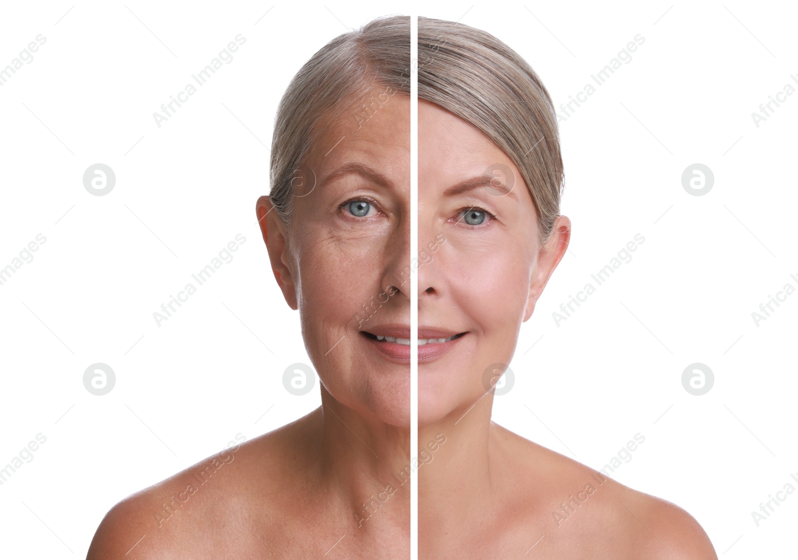 Senior woman showing face before and after collagen consumption on white background. Collage of photos comparing skin condition Image of Senior woman showing face before and after collagen consumption on white background. Collage of photos comparing skin condition
