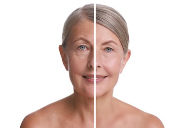 Image of Senior woman showing face before and after collagen consumption on white background. Collage of photos comparing skin condition