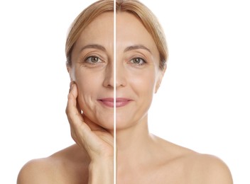 Image of Woman showing face before and after collagen consumption on white background. Collage of photos comparing skin condition