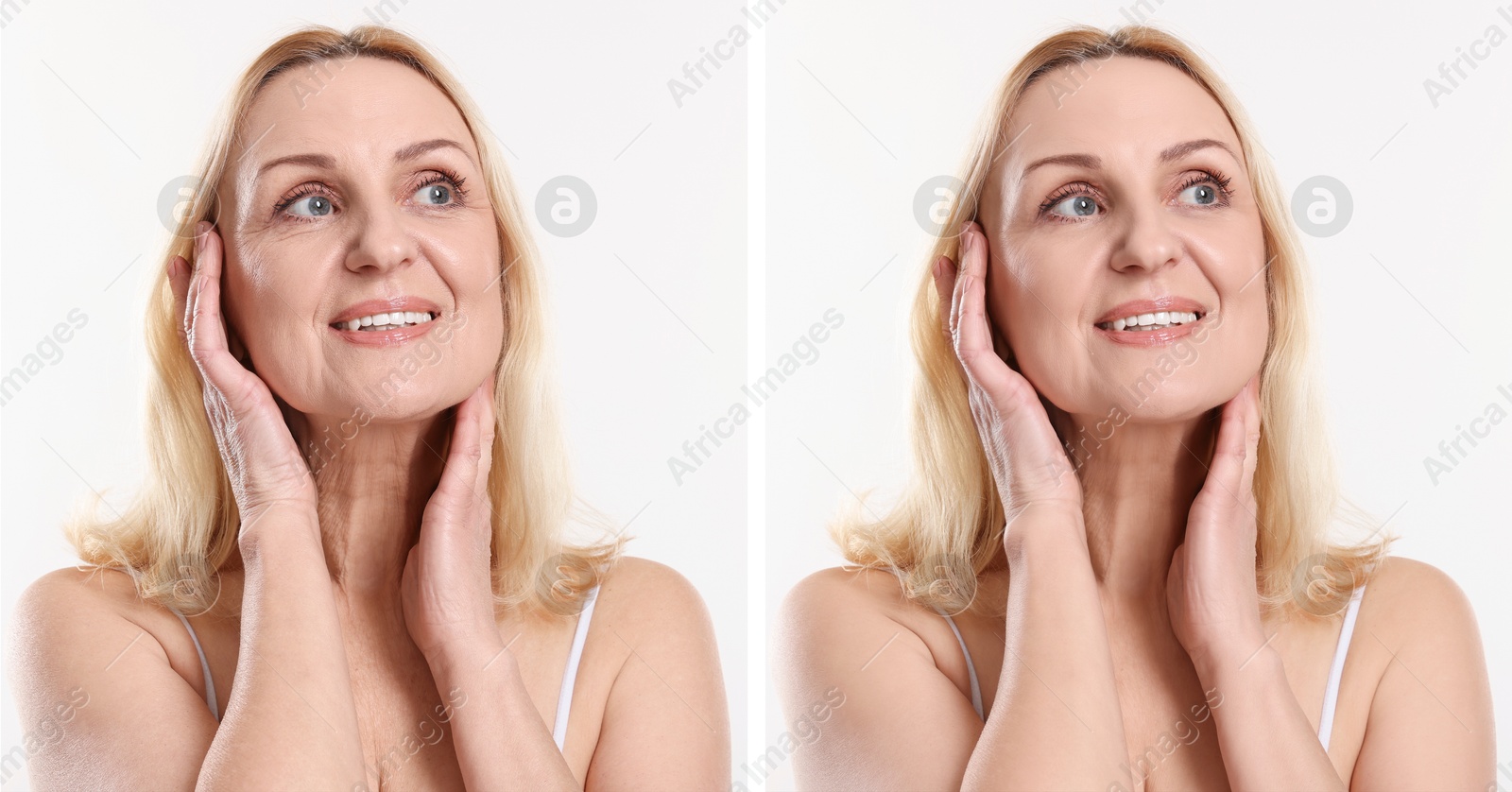 Senior woman showing face before and after collagen consumption on white background. Collage of photos comparing skin condition Image of Senior woman showing face before and after collagen consumption on white background. Collage of photos comparing skin condition