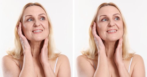 Image of Senior woman showing face before and after collagen consumption on white background. Collage of photos comparing skin condition