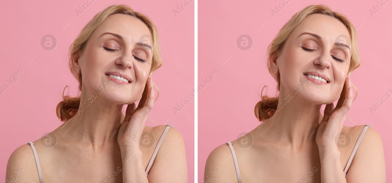 Senior woman showing face before and after collagen consumption on pink background. Collage of photos comparing skin condition Image of Senior woman showing face before and after collagen consumption on pink background. Collage of photos comparing skin condition