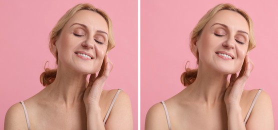 Image of Senior woman showing face before and after collagen consumption on pink background. Collage of photos comparing skin condition