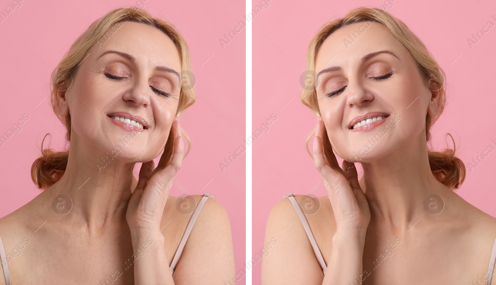 Senior woman showing face before and after collagen consumption on pink background. Collage of photos comparing skin condition Image of Senior woman showing face before and after collagen consumption on pink background. Collage of photos comparing skin condition