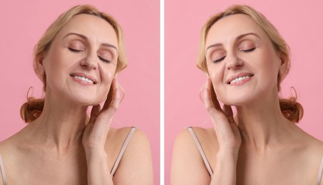 Image of Senior woman showing face before and after collagen consumption on pink background. Collage of photos comparing skin condition