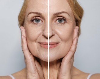 Image of Senior woman showing face before and after collagen consumption on light grey background, closeup. Collage of photos comparing skin condition