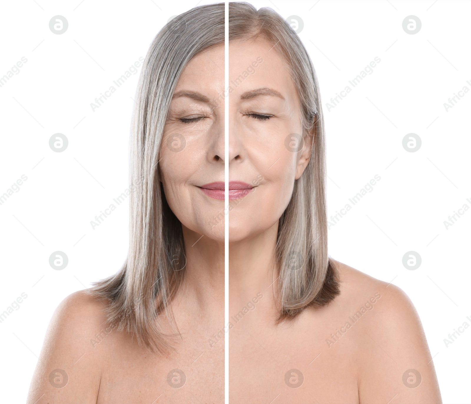 Senior woman showing face before and after collagen consumption on white background. Collage of photos comparing skin condition Image of Senior woman showing face before and after collagen consumption on white background. Collage of photos comparing skin condition