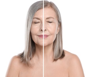 Image of Senior woman showing face before and after collagen consumption on white background. Collage of photos comparing skin condition