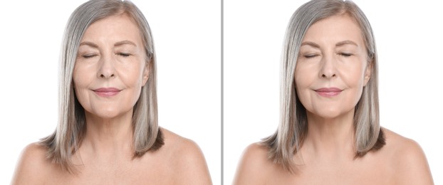 Image of Senior woman showing face before and after collagen consumption on white background. Collage of photos comparing skin condition