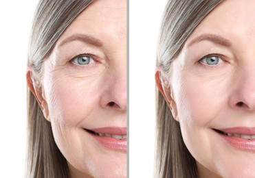 Image of Senior woman showing face before and after collagen consumption on white background, closeup. Collage of photos comparing skin condition