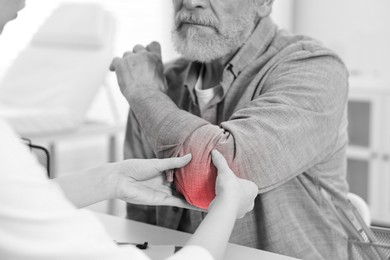 Image of Arthritis. Doctor examining patient's elbow in hospital, closeup. Black and white toning with red color accent