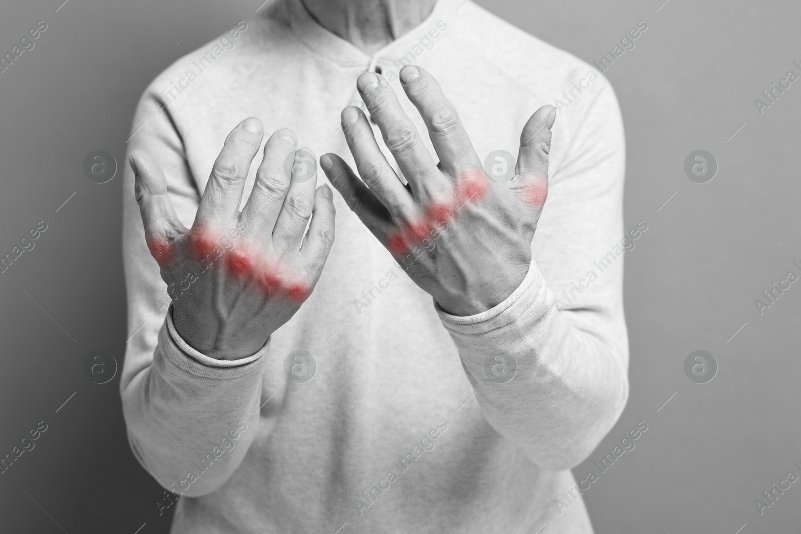 Arthritis. Man suffering from pain in hands, closeup. Black and white toning with red color accent Image of Arthritis. Man suffering from pain in hands, closeup. Black and white toning with red color accent