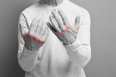 Image of Arthritis. Man suffering from pain in hands, closeup. Black and white toning with red color accent