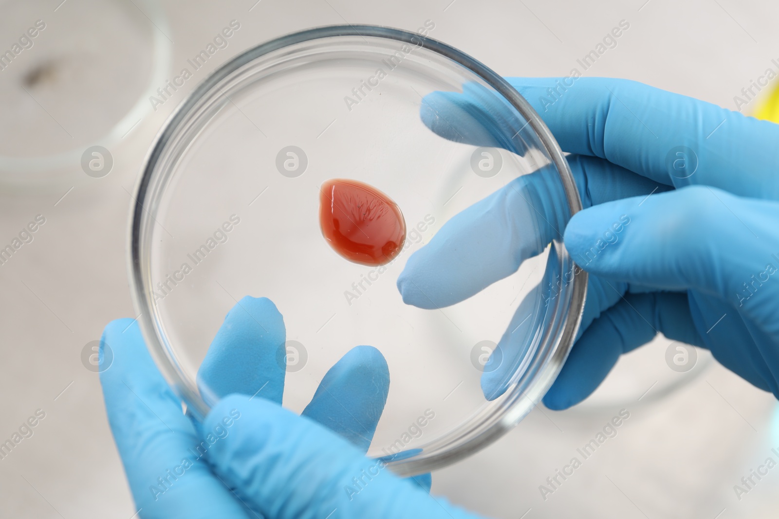 Scientist holding Petri dish with sample on blurred background, closeup Photo of Scientist holding Petri dish with sample on blurred background, closeup