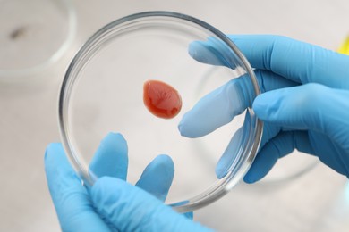 Photo of Scientist holding Petri dish with sample on blurred background, closeup