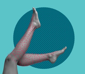Image of Epilation, creative collage. Woman showing legs with drawn hairs against light blue background with circle