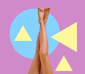 Image of Epilation, creative collage. Woman showing legs with drawn hairs against violet background with geometric shapes
