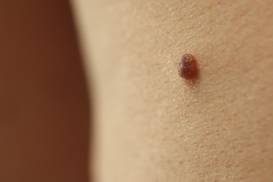 Photo of Man with mole on his skin against brown background, closeup. Space for text