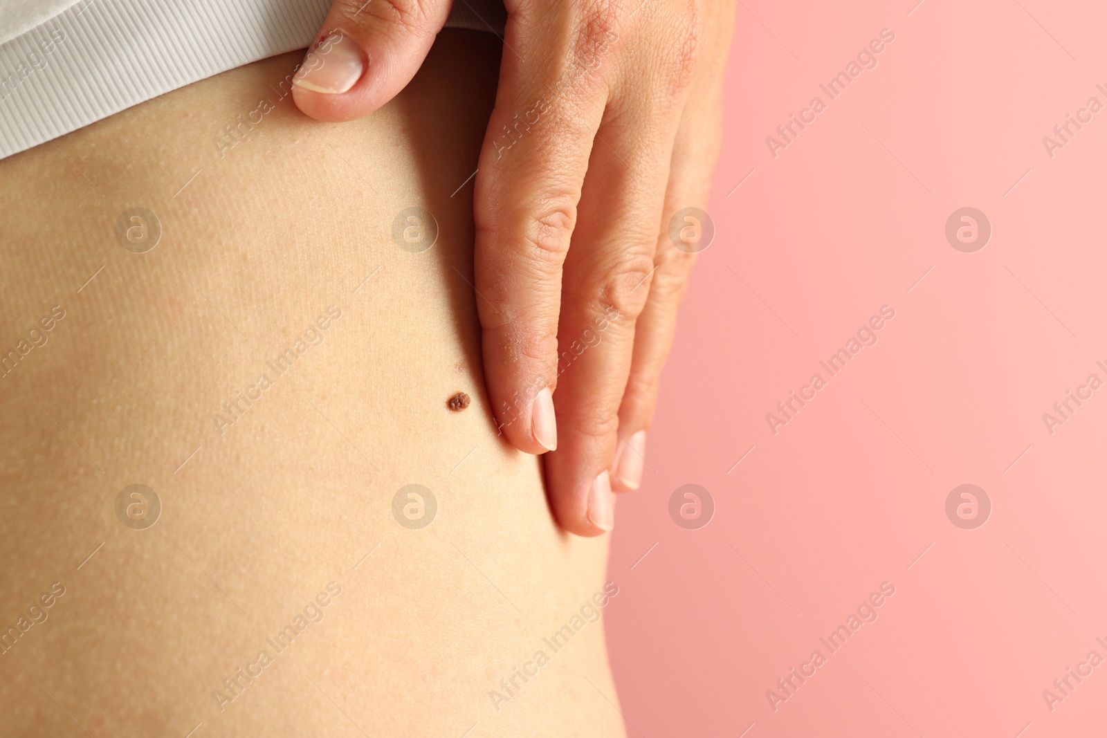 Woman with mole on her skin against pink background, closeup. Space for text Photo of Woman with mole on her skin against pink background, closeup. Space for text