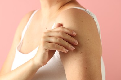 Photo of Woman with moles on her skin against pink background, closeup