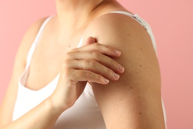 Photo of Woman with moles on her skin against pink background, closeup