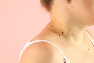 Photo of Woman with moles on her skin against pink background, closeup