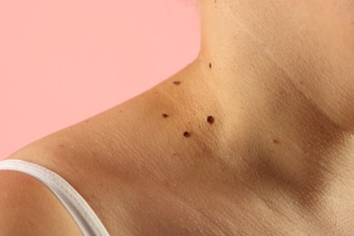 Photo of Woman with moles on her skin against pink background, closeup