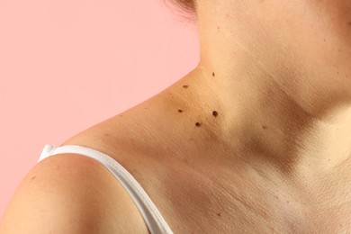 Photo of Woman with moles on her skin against pink background, closeup