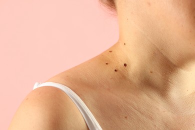 Photo of Woman with moles on her skin against pink background, closeup