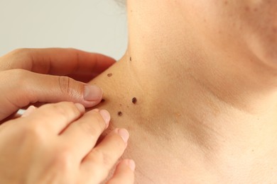 Photo of Doctor examining woman's moles on light grey background, closeup