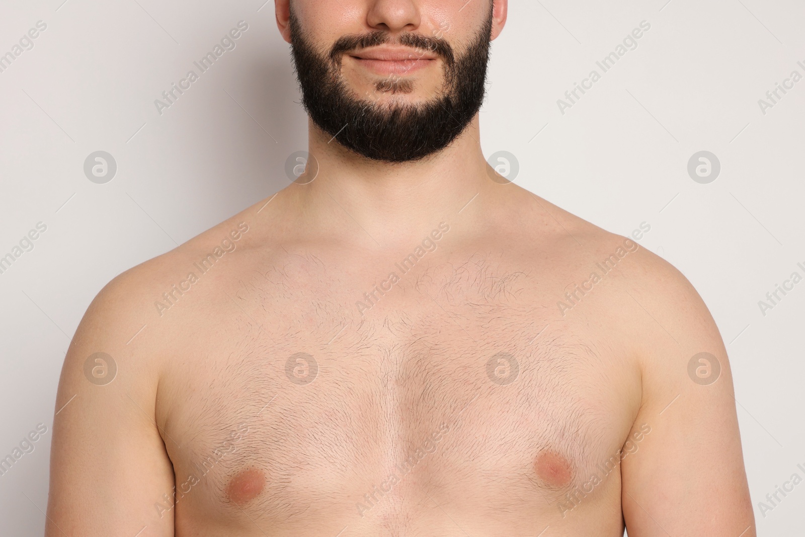 Man after scoliosis treatment on light background, closeup Photo of Man after scoliosis treatment on light background, closeup