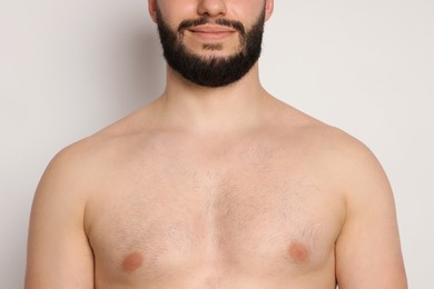 Photo of Man after scoliosis treatment on light background, closeup