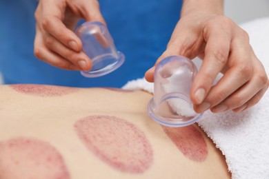 Photo of Therapist giving cupping treatment to patient in spa salon, closeup