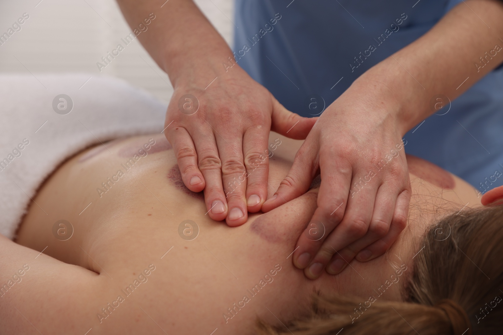 Cupping therapy. Woman receiving professional massage in spa salon, closeup Photo of Cupping therapy. Woman receiving professional massage in spa salon, closeup