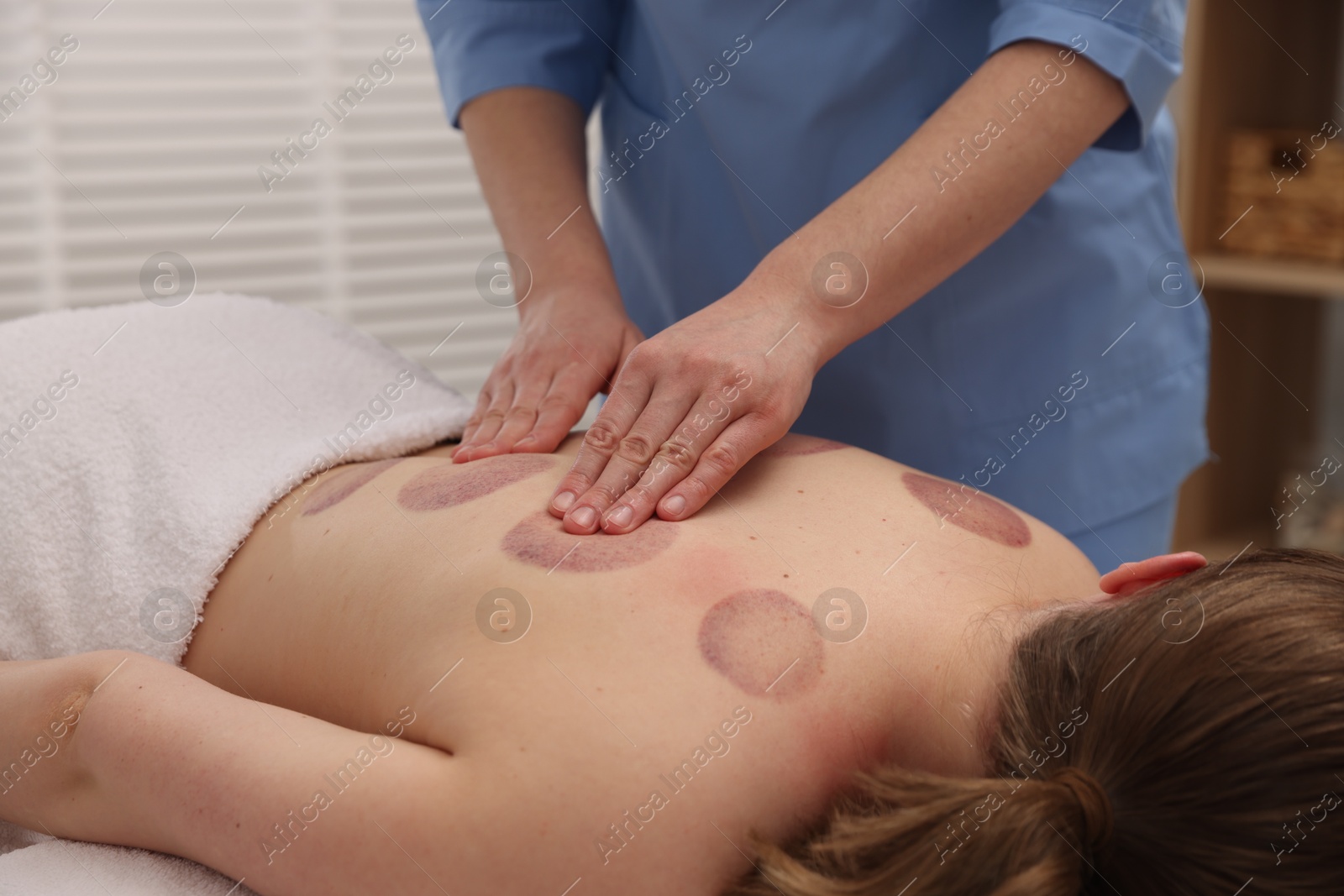 Cupping therapy. Woman receiving professional massage in spa salon, closeup Photo of Cupping therapy. Woman receiving professional massage in spa salon, closeup