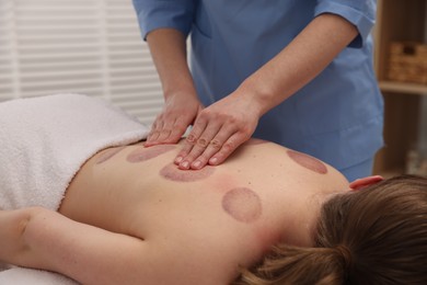Photo of Cupping therapy. Woman receiving professional massage in spa salon, closeup