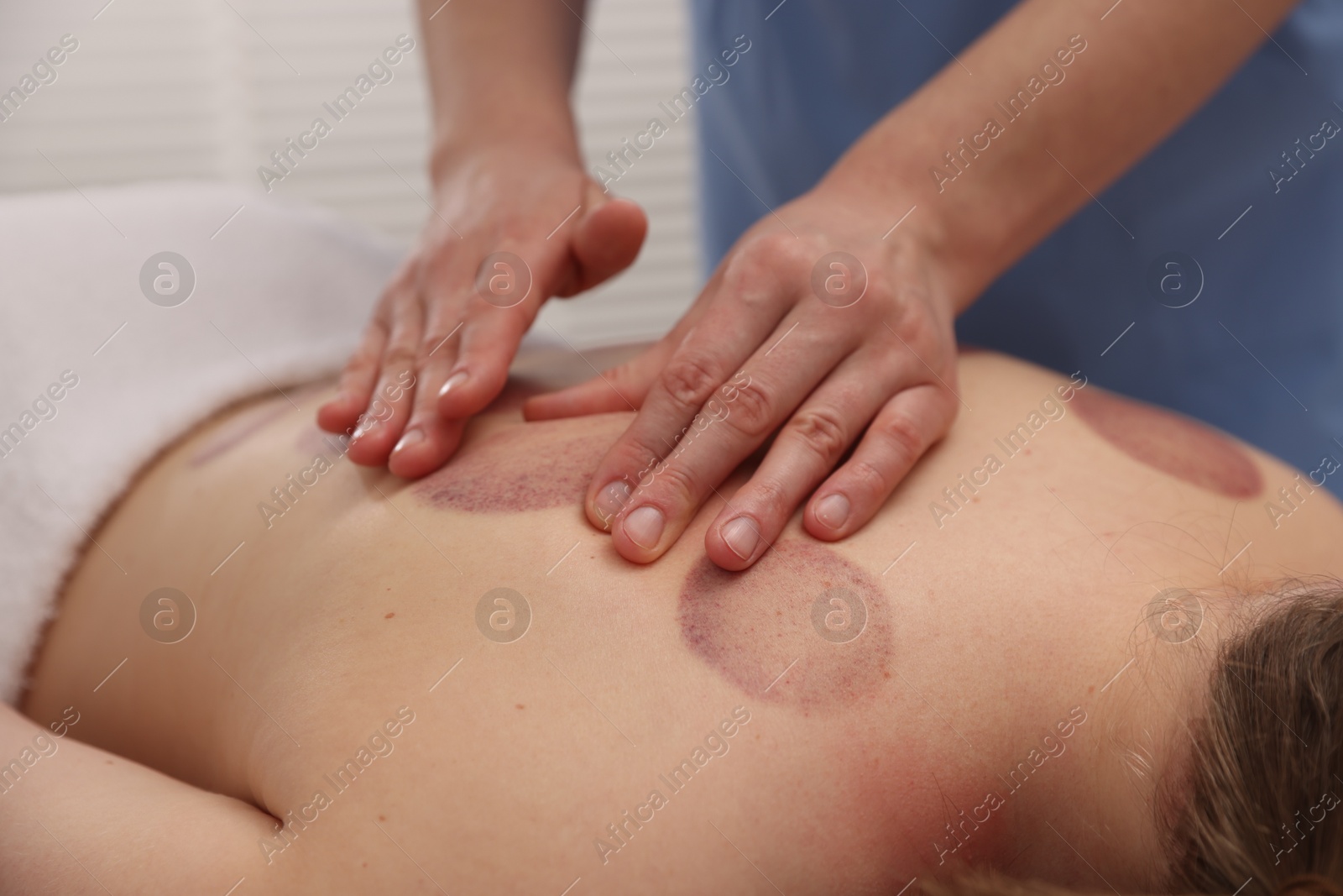 Cupping therapy. Woman receiving professional massage in spa salon, closeup Photo of Cupping therapy. Woman receiving professional massage in spa salon, closeup